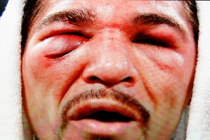 Manny Pacquiao v Antonio Margarito