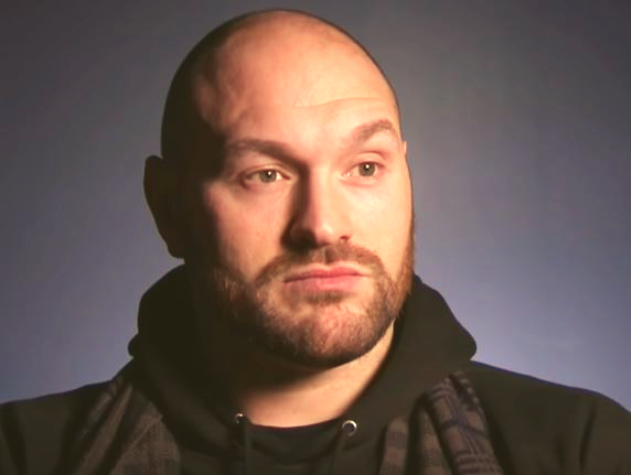 Bald Tyson Fury